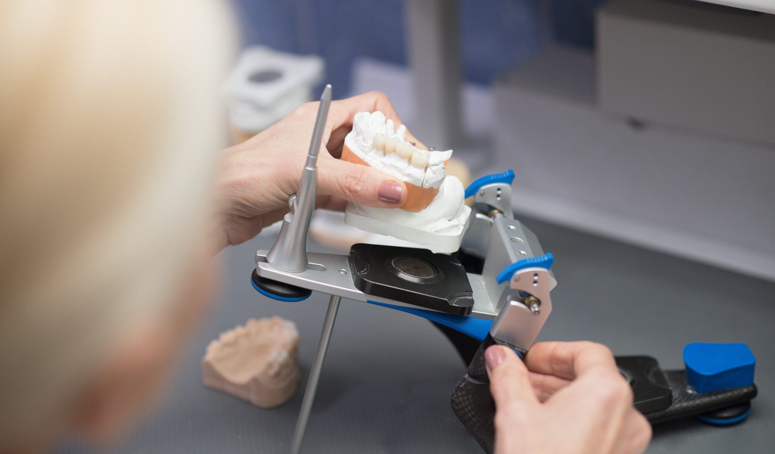 Top Benefits of Using a Bone Bracket Gauge in Dental Practices